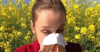 Common Allergic Symptoms