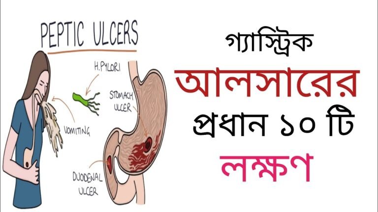 গ্যাস্ট্রিক আলসার এর লক্ষণ