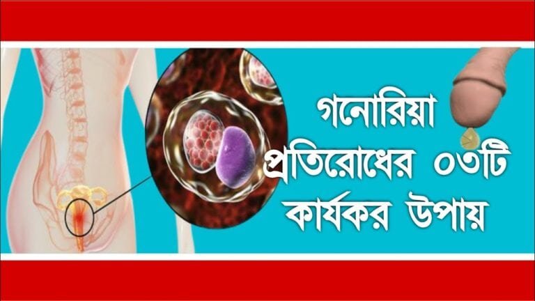 গনোরিয়া রোগের লক্ষণ