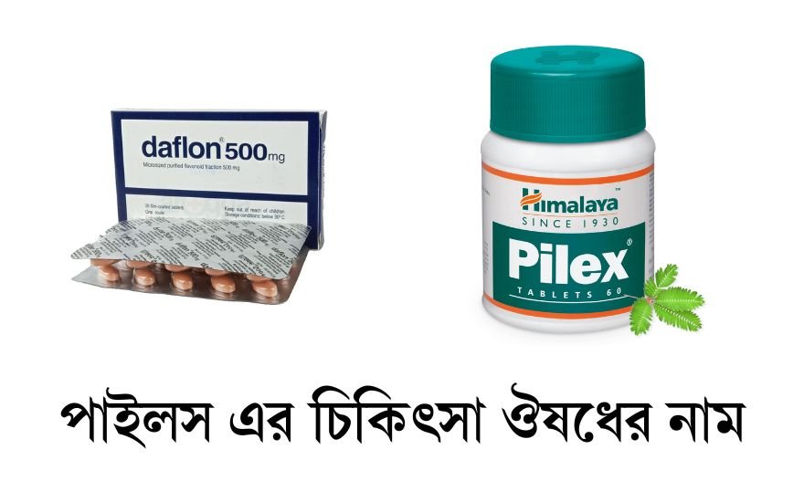 পাইলস এর চিকিৎসা ঔষধের নাম