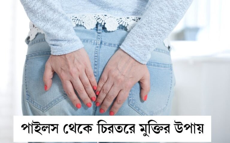 পাইলস থেকে চিরতরে মুক্তির উপায়