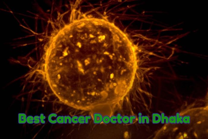 Best Cancer Doctor in Dhaka